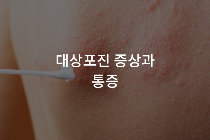 대상포진 무료접종 대상